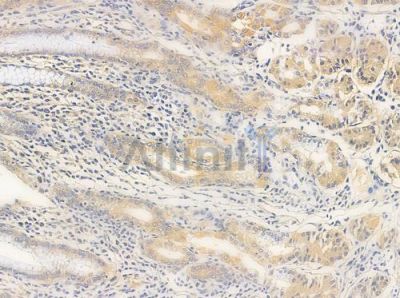 LRAT Antibody - AF0486 at 1/100 staining human normal gastric tissue by IHC-P.