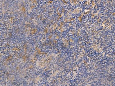 LRAT Antibody - AF0486 at 1/100 staining human normal tonsil tissue by IHC-P.