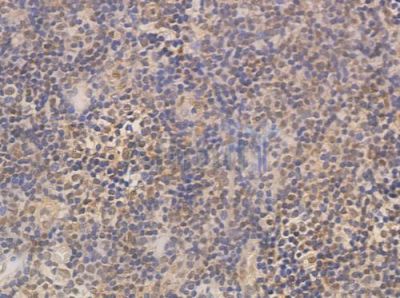 XRN2 Antibody - AF0490 at 1/100 staining human normal tonsil tissue by IHC-P.