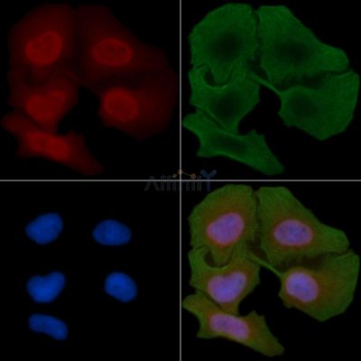 AL2S7 Antibody - AF0509 staining Hela cells(30min of UV treatment) by IF/ICC.