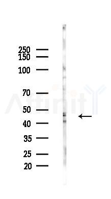 ILKAP Antibody - Western blot analysis of lysates from HepG2 cells(heat-shock,45min treatment), using ILKAP Antibody at 1/1000 dilution.