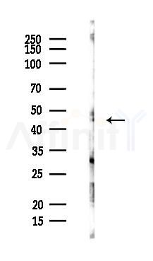 ILKAP Antibody - Western blot analysis of lysates from PC12 cells, using ILKAP Antibody at 1/1000 dilution.