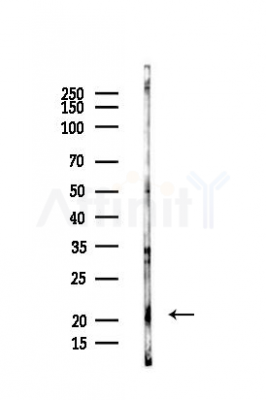 TFAM Antibody - Western blot analysis of lysates from PC12 cells, using TFAM Antibody at 1/1000 dilution.