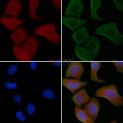 ADCK1 Antibody - AF0541 staining Hela cells by IF/ICC.