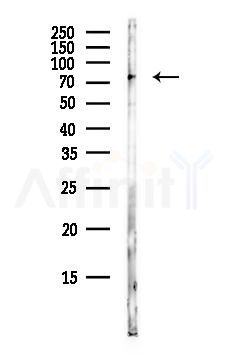 TGM2 Antibody - Western blot analysis of lysates from EC304 cells(heat-shock,45min treatment), using TGM2 Antibody at 1/1000 dilution.