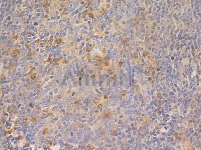 Ephrin A5 Antibody - AF0560 at 1/100 staining human normal tonsil tissue by IHC-P.