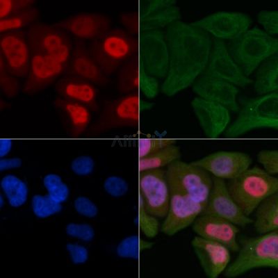 PIAS1 Antibody - AF0561 staining Hela cells by IF/ICC.