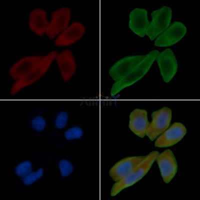 STEAP4 Antibody - AF0574 staining Hela cells(30min of UV treatment) by IF/ICC.