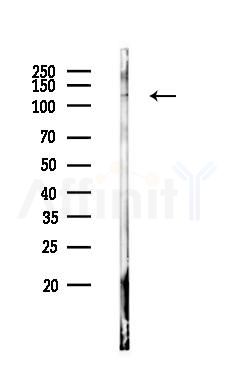 HDAC5 Antibody - Western blot analysis of lysates from B16F10-LUC cells, using HDAC5 Antibody at 1/1000 dilution.