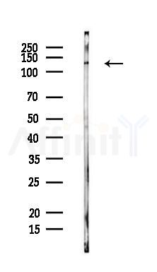 HDAC5 Antibody - Western blot analysis of lysates from PC12 cells, using HDAC5 Antibody at 1/1000 dilution.