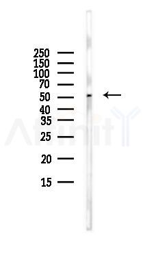 ITPK1 Antibody - Western blot analysis of lysates from HUVEC cells(starvation,24h treatment), using ITPK1 Antibody at 1/1000 dilution.