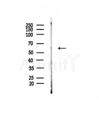 EGR1 Antibody - Western blot analysis of lysates from Mouse liver, using EGR1 Antibody at 1/1000 dilution.