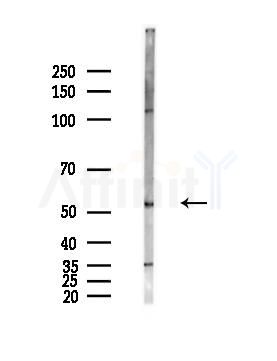DOK3 Antibody - Western blot analysis of lysates from PC12 cells(LPS,4h treatment), using DOK3 Antibody at 1/1000 dilution.