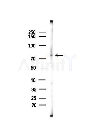 TNAP2 Antibody - Western blot analysis of lysates from HUVEC cells(heat-shock,45min treatment), using TNAP2 Antibody at 1/1000 dilution.