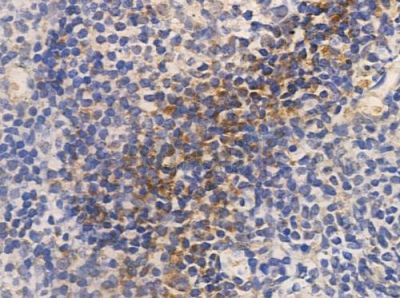 TNAP2 Antibody - AF0630 at 1/100 staining human normal tonsil tissue by IHC-P.