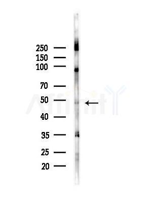 NDF2 Antibody - Western blot analysis of lysates from A375 cells(heat-shock,45min treatment), using NDF2 Antibody at 1/1000 dilution.