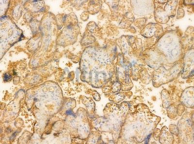 TM16G Antibody - AF0648 at 1/100 staining human normal placenta tissue by IHC-P.