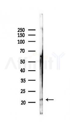 COX42 Antibody - Western blot analysis of lysates from Hela cells(starvation,24h treatment), using COX42 Antibody at 1/1000 dilution.