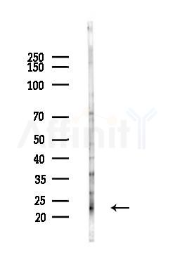 HAND1 Antibody - Western blot analysis of lysates from HepG2 cells(heat-shock,45min treatment), using HAND1 Antibody at 1/1000 dilution.