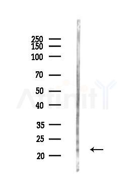 HAND1 Antibody - Western blot analysis of lysates from Mouse liver, using HAND1 Antibody at 1/1000 dilution.