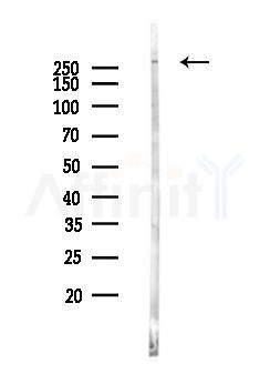 KAT3B / p300 Antibody - Western blot analysis of lysates from B16F10-LUC cells, using KAT3B / p300 Antibody at 1/1000 dilution.