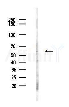 Cytochrome P450 2U1 Antibody - Western blot analysis of lysates from HepG2 cells(heat-shock,45min treatment), using Cytochrome P450 2U1 Antibody at 1/1000 dilution.