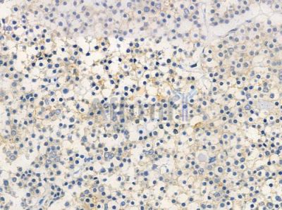 EPN1 Antibody - AF0700 at 1/100 staining human pituitary adenoma by IHC-P.