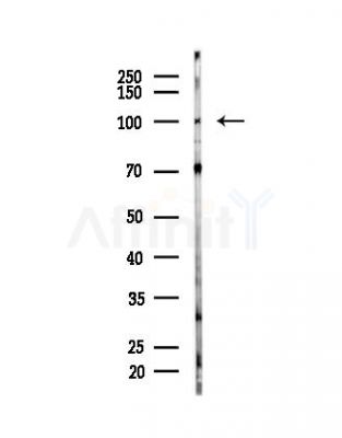 PSMD2 Antibody - Western blot analysis of lysates from EC304 cells, using PSMD2 Antibody at 1/1000 dilution.