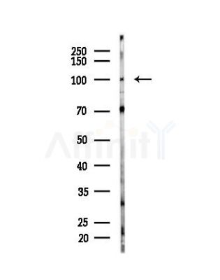 PSMD2 Antibody - Western blot analysis of lysates from EC304 cells, using PSMD2 Antibody at 1/1000 dilution.