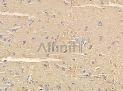 GASP1 Antibody - AF0712 at 1/100 staining human glioblastoma by IHC-P.
