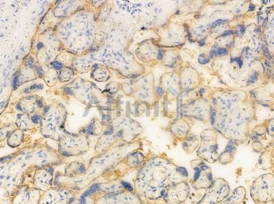 RBP5 Antibody - AF0720 at 1/100 staining human normal placenta tissue by IHC-P.