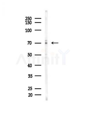 GRP78 Antibody - Western blot analysis of lysates from EC304 cells, using GRP78 Antibody at 1/1000 dilution.
