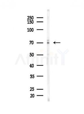 GRP78 Antibody - Western blot analysis of lysates from EC304 cells, using GRP78 Antibody at 1/1000 dilution.