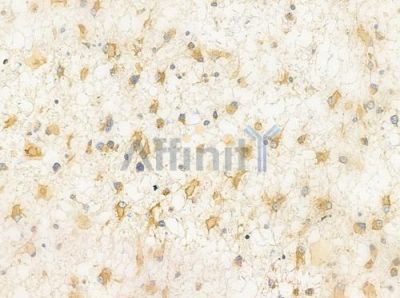 GRP94 Antibody - AF0735 at 1/100 staining human astrocytoma by IHC-P.