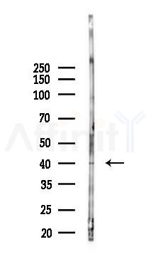 DOK6 Antibody - Western blot analysis of lysates from HepG2 cells(heat-shock,45min treatment), using DOK6 Antibody at 1/1000 dilution.
