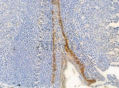 Cytokeratin 15 Antibody - AF0790 at 1/100 staining human normal tonsil tissue by IHC-P.