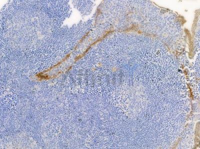 Cytokeratin 15 Antibody - AF0790 at 1/100 staining human normal tonsil tissue by IHC-P.
