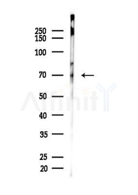 NF-kB p65 Antibody - Western blot analysis of lysates from EC304 cells, using NF-kB p65 Antibody at 1/1000 dilution.