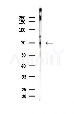 NF-kB p65 Antibody - Western blot analysis of lysates from EC304 cells, using NF-kB p65 Antibody at 1/1000 dilution.