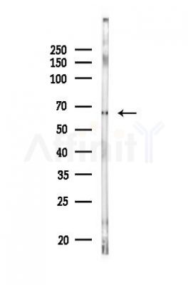 ACSS1 Antibody - Western blot analysis of lysates from MC-3T3-E1 cells, using ACSS1 Antibody at 1/1000 dilution.