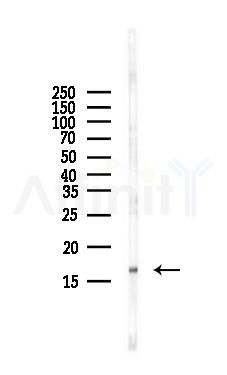 Acetyl-Histone H3 (Lys18) Antibody - Western blot analysis of lysates from HUVEC cells(starvation,24h treatment), using Acetyl-Histone H3 (Lys18) Antibody at 1/1000 dilution.