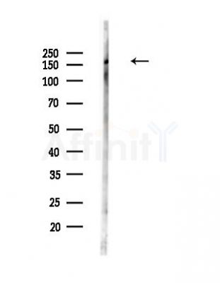 Phospho-AS160 (Ser318) Antibody - Western blot analysis of lysates from Mouse lung, using Phospho-AS160 (Ser318) Antibody at 1/1000 dilution.