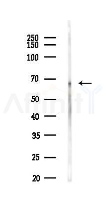 Phospho-Atg14 (Ser29) Antibody - Western blot analysis of lysates from Mouse liver, using Phospho-Atg14 (Ser29) Antibody at 1/1000 dilution.