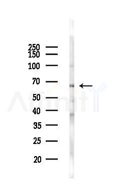 Phospho-Atg14 (Ser29) Antibody - Western blot analysis of lysates from HUVEC cells(starvation,24h treatment), using Phospho-Atg14 (Ser29) Antibody at 1/1000 dilution.