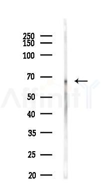 Phospho-Atg14 (Ser29) Antibody - Western blot analysis of lysates from Mouse liver, using Phospho-Atg14 (Ser29) Antibody at 1/1000 dilution.