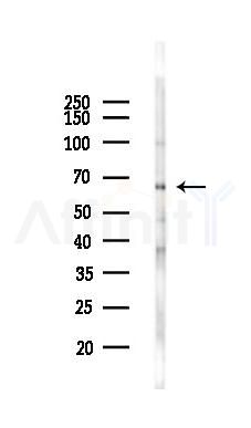 Phospho-Atg14 (Ser29) Antibody - Western blot analysis of lysates from HUVEC cells(starvation,24h treatment), using Phospho-Atg14 (Ser29) Antibody at 1/1000 dilution.