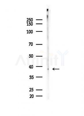 Phospho-CrkL (Tyr207) Antibody - Western blot analysis of lysates from EC304 cells, using Phospho-CrkL (Tyr207) Antibody at 1/1000 dilution.