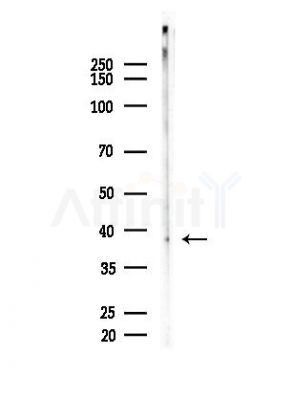 Phospho-CrkL (Tyr207) Antibody - Western blot analysis of lysates from EC304 cells, using Phospho-CrkL (Tyr207) Antibody at 1/1000 dilution.