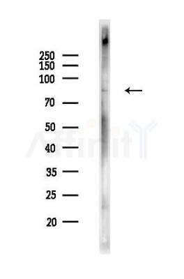 Phospho-DR6 (Ser562) Antibody - Western blot analysis of lysates from PC12 cells(heat-shock,45min treatment), using Phospho-DR6 (Ser562) Antibody at 1/1000 dilution.