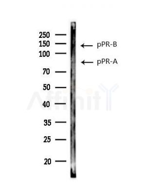 Phospho-Progesterone Receptor (Ser190) Antibody - Western blot analysis of lysates from RAW264.